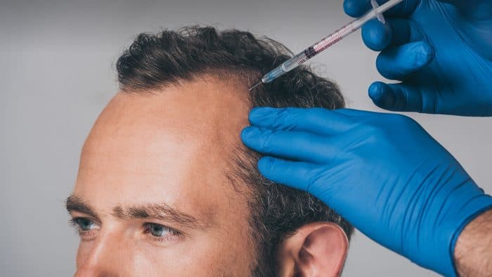 Thinning hair and hair loss is an unfortunate aspect of aging for both men and women and a common sign of hormone imbalance. Platelet Rich Plasma (PRP) is a completely natural treatment...